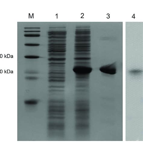 Sds Page Analysis And Western Blotting Detection Of Recombinant Protein