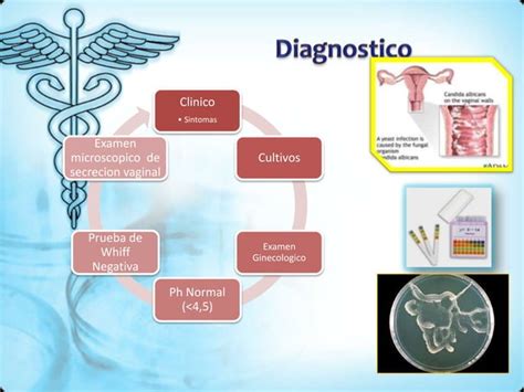 Infecciones Del Tracto Genital Inferior Ppt