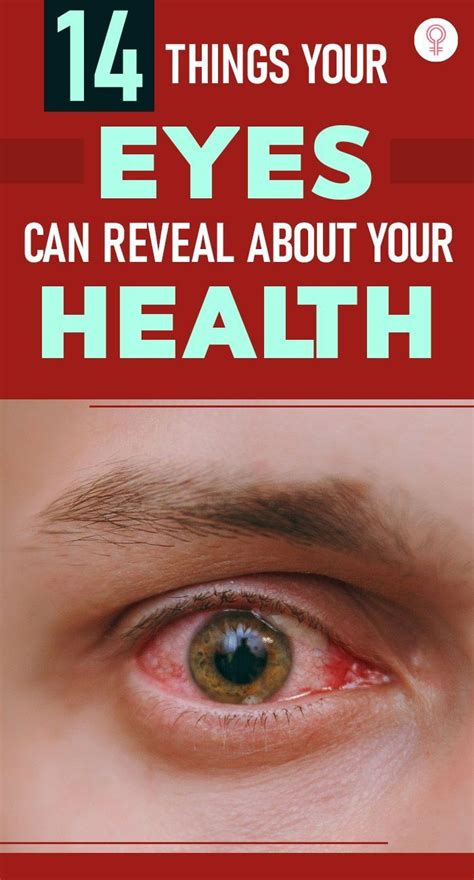 14 Things Your Eyes Can Reveal About Your Health Artofit