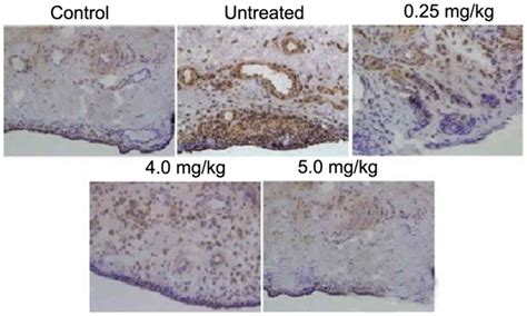 Articular Cartilage Degradation Is Prevented By Tanshinone Iia Through