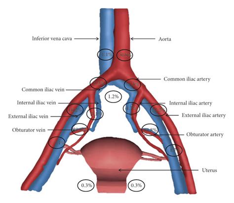 The Distribution Of Sentinel Lymph Nodes Download Scientific Diagram