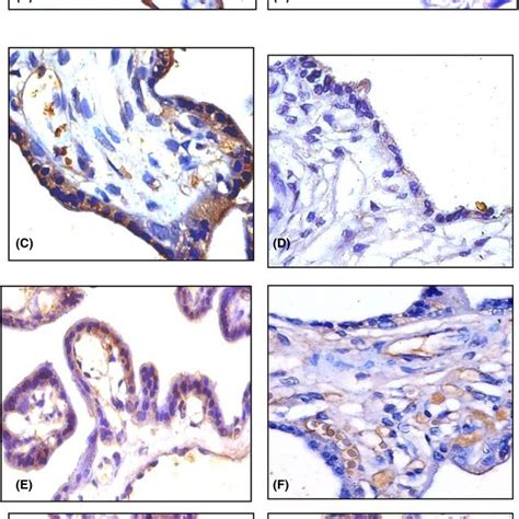 Immunohistochemical Expression Of Pro‐inflammatory Cytokines