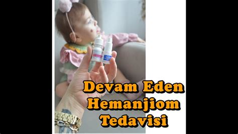 Hemanjiom da Tedavi Süreci YouTube