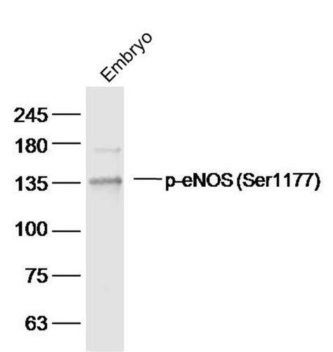 Phospho Enos Ser1177 Antibody Bs 3447r