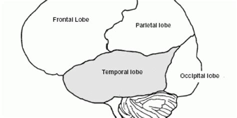 Brain tumor in right temporal lobe recovery time? | Nervous System ...