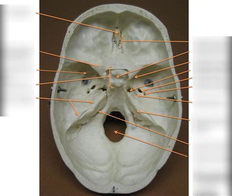 Biol 430 Skull And Location Of Skull Features Diagram Quizlet