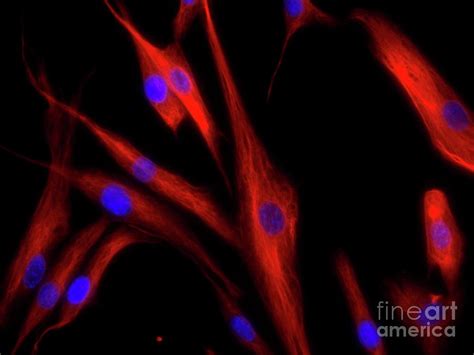 Dermal Fibroblast Cells Photograph By Daniel Schroen Cell Applications