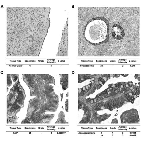 Immunohistochemical Staining Of Normal Ovarian Epithelium A Mucinous