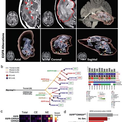 Molecular Alteration Landscape Of Idh Wild Type Glioma A The Spectrum Download Scientific