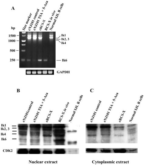 Expression Of Ikaros Isoforms In Sjl Lymphomas And Normal Splenic B