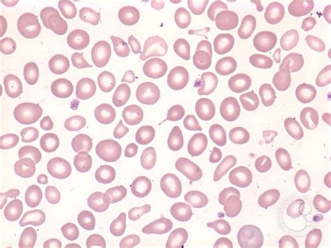 Hematology Cell Identification With Pictures Flashcards Quizlet