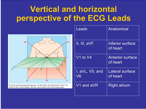 World's Tragic In Medlife,.....You May Know Or Not: ECG TUTORIAL