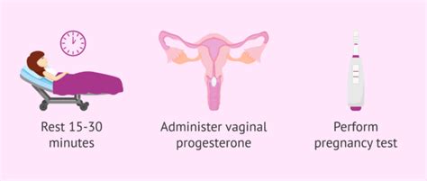 The Intrauterine Insemination Iui Process Step By Step