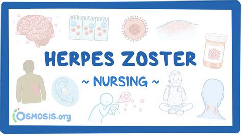 Herpes Zoster Nursing Video Causes Osmosis