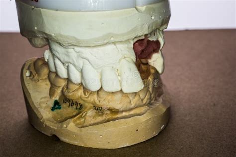 Denture Impression Made of Plaster with Implants Stock Image - Image of parts, upper: 192990459