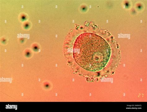 Human zygote. Light micrograph of a human zygote (the primitive embryo ...