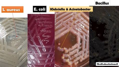 Escherichia Coli Colony Morphology