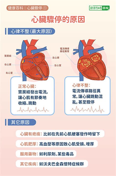 心臟驟停有3症狀 2招急救防猝死！急救方法全圖解 心跳 心律不整 Cpr 新唐人电视台