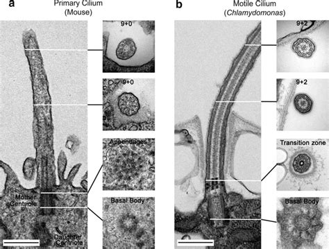 Cilia Electron Microscopes