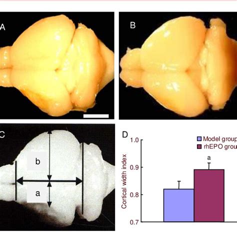 Recombinant Human Erythropoietin RhEPO Induced Cerebral Cortical