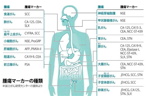 人間ドックの腫瘍マーカー検査は役に立たない がん治療の虚実