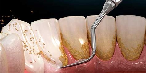 Especialidades Dentales Vittaoral Odontolog A