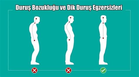 Duru Bozuklu U In En Etkili Dik Duru Egzersizleri