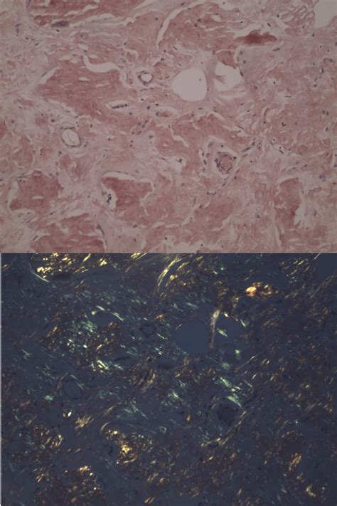demonstration  staining techniques  principles  polarization