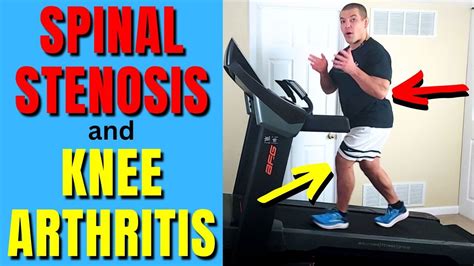 Surprising Benefits Of Incline Treadmill Walking For Knee Arthritis