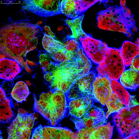 Innovative Applications Of Optics In Bioimaging Techniques