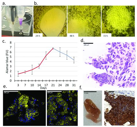 Characteristics Of A New 3D Bioprinted Tissue Mimetic Model Of ZR75 1