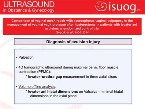 Uog Journal Club Comparison Of Vaginal Mesh Repair With Sacrospinous