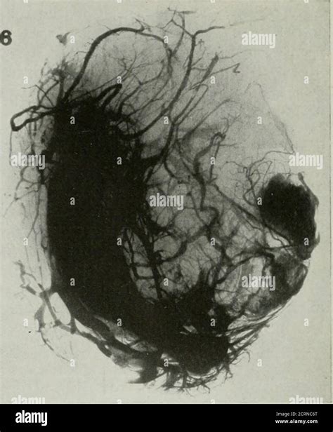 Blood Supply Of Pelvis Hi Res Stock Photography And Images Alamy