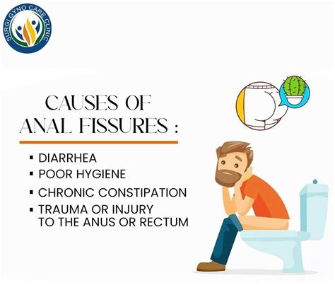 Causes Of Anal Fissure Best Piles Treatment In Agra