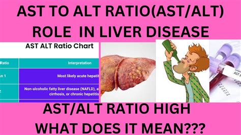 WHAT IS AST ALT RATIO CAUSES OF HIGH AST TO ALT RATIO AST ALT RATIO