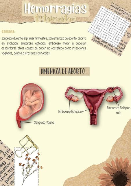 Embarazo Hemorragias Er Trimestre Med Time Udocz