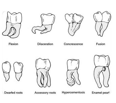 the different types of teeth and their corresponding parts are shown in this diagram, which ...