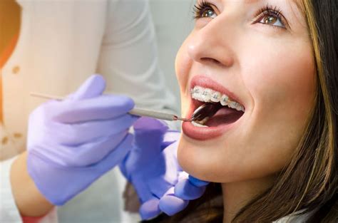 Different Types Of Orthodontic Treatment