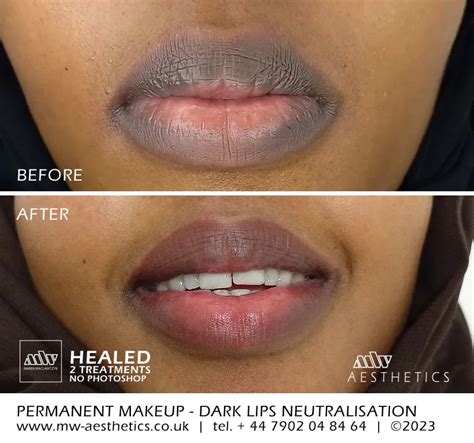 Permanent Full Lip Color