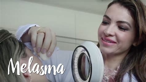 Melasma by Farmácias Pague Menos YouTube