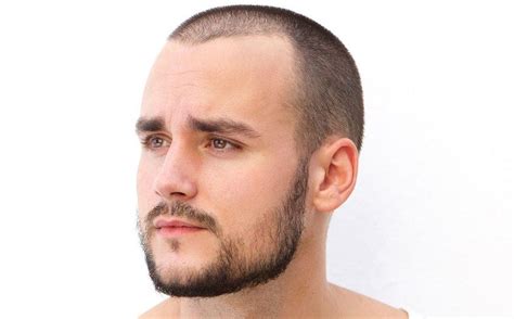 Patchy Beard 13 Quick Easy Hacks To Fix Bald Spot