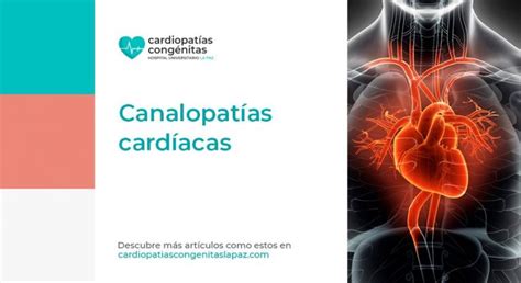 Canalopatías Cardíacas archivos Cardiopatías Congénitas La Paz