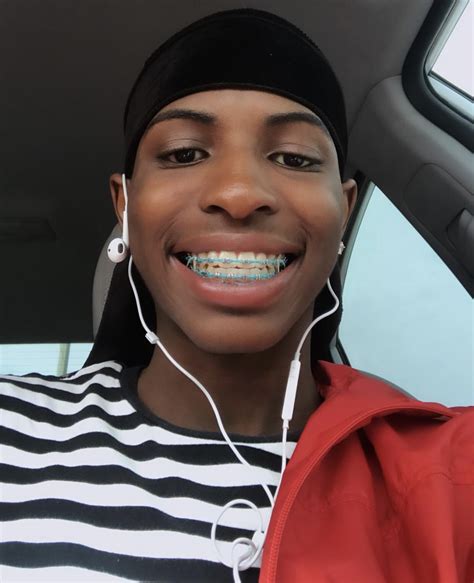 Best Braces Colors For Brown Skin Ipc12011