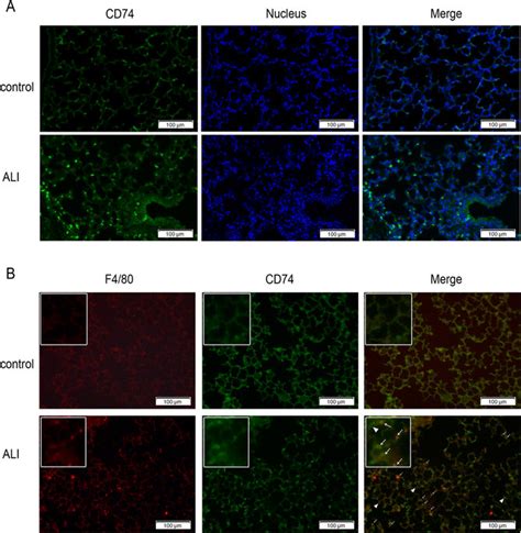 Immunofluorescence Staining Of CD74 In Lungs Immunofluorescence