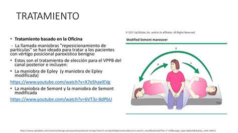 VÉRTIGO POSTURAL PAROXÍSTICO BENIGNO PPT Descarga Gratuita