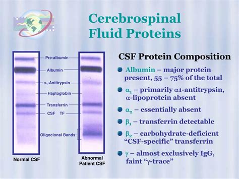 PPT - High Resolution Protein Electrophoresis PowerPoint Presentation ...