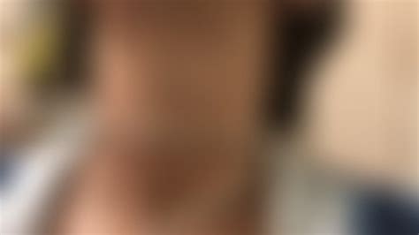 Neck Brace Fetish Porn Tube Video Clips Clips Sale