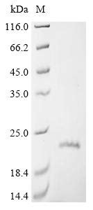 Recombinant Human Claudin 1 CLDN1 跨膜蛋白 武汉华美生物