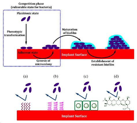 Schematic Diagram Represents Bacterial Colonization On The Implant