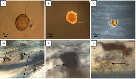 Identifikasi Mikoriza Abuskula Secara Mikroskopis Pada Rhizosfer